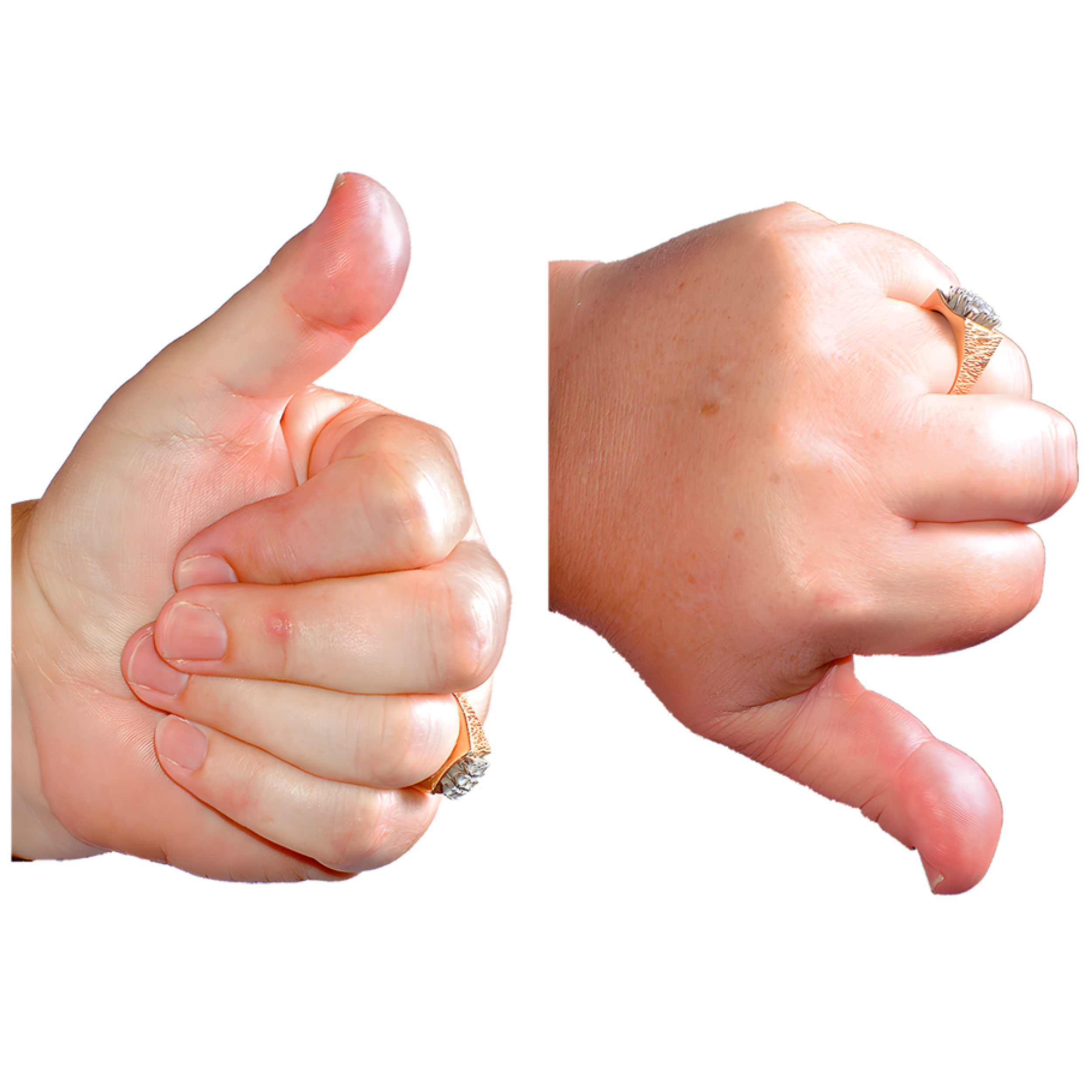 A thumbs up and thumbs down