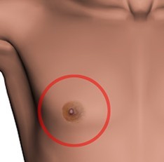 Image of a mans breast