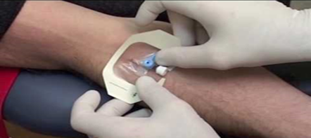An outstretched arm being prepared for a needle to be insertedwith  